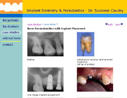 Dr. Caudry case study