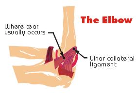 elbow