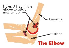 elbow